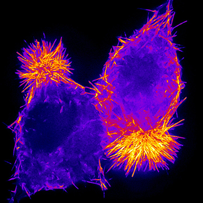 Fluorescence image of two human epithelial cells (bright purple) with their apical ends pointing in opposite directions. You can see the highest concentration of orange (actin) in rods on their apical sides (very vivid), and some orange rods along the outside border of the cells (less vivid).