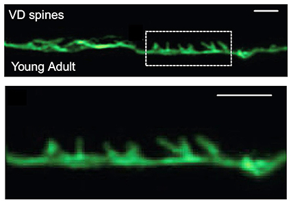 Two fluorescence microscopy images. On top, a stringy-looking neuron (green) laid out horizontally across the screen. Text on the image says “VD spines” and “Young Adult.” A box with dashed lines indicates the area shown in the bottom portion, which is enlarged. It clearly shows the main body of the neuron with short spiny protrusions coming out the top. Scale bars are 1 µm.