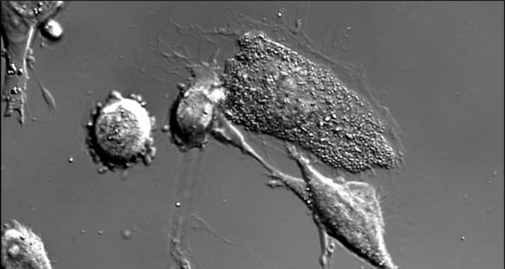 Still of a video showing a dying melanoma cell.