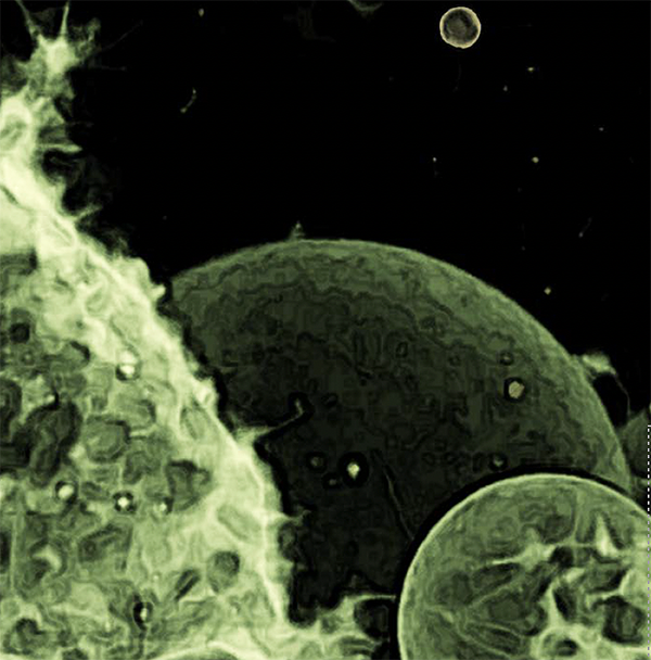 Abstract-looking image of cells and extracellular vesicles near them. Everything is hued in green on a black background.
