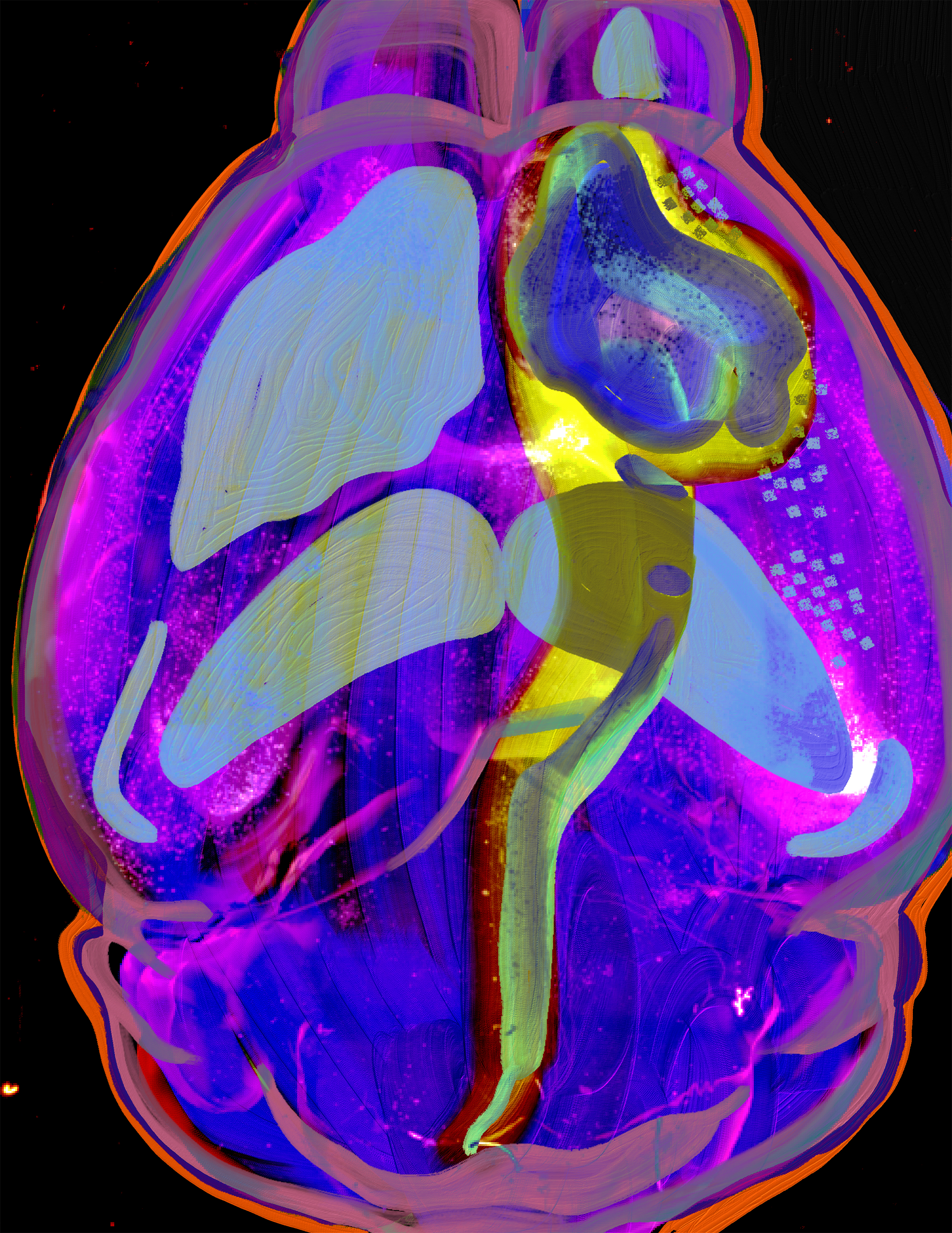 An artistic interpretation of a two-dimensional brain representation generated by José Maldonado through whole-brain imaging carried out at the Vanderbilt Neurovisualization Lab. The illustration was made by the author of the article, Kendra H. Oliver.