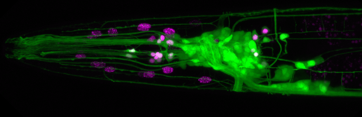 The C. elegans brain with all neurons expressing green fluorescent protein and a subset of neurons involved in feeding expressing a magenta nuclear marker. The brain looks like a tangle of green fluorescent string knotted on the right half of the image, with nodules of purple primarily on the left side.