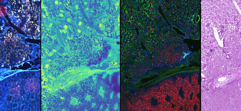 Multimodal Imaging / Human Kidney