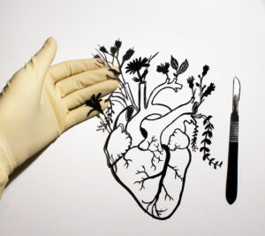 Illustration of a heart next to a scalpel