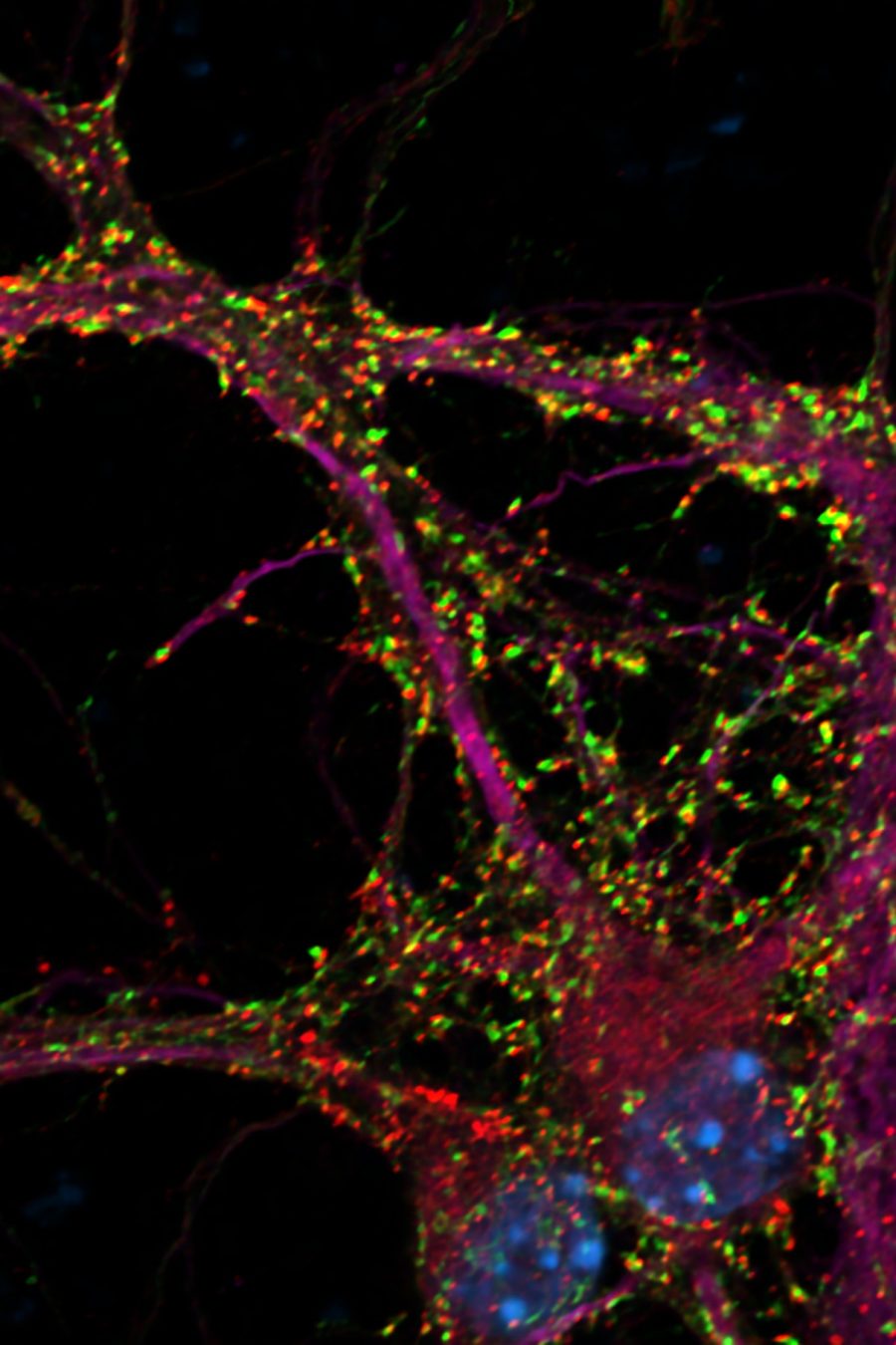 Photo Credit: Krassimira Garbett, Sando Lab